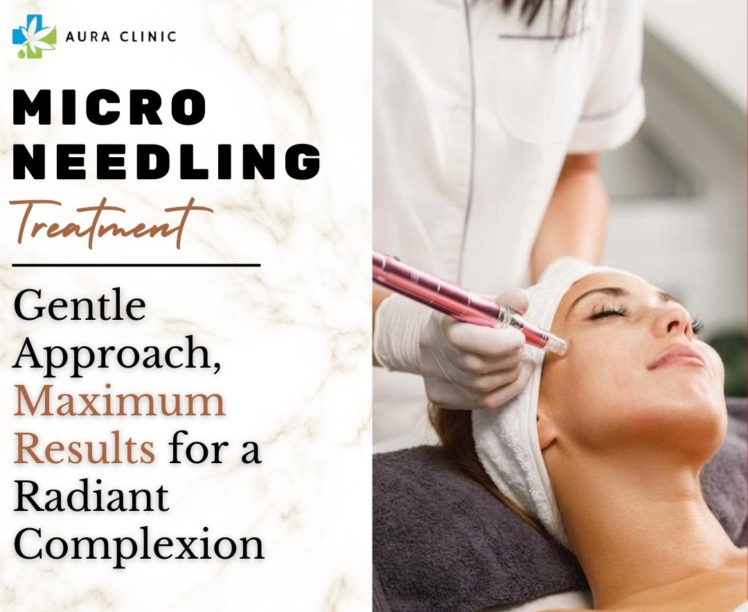 BENFITS OF MICRONEEDLING
