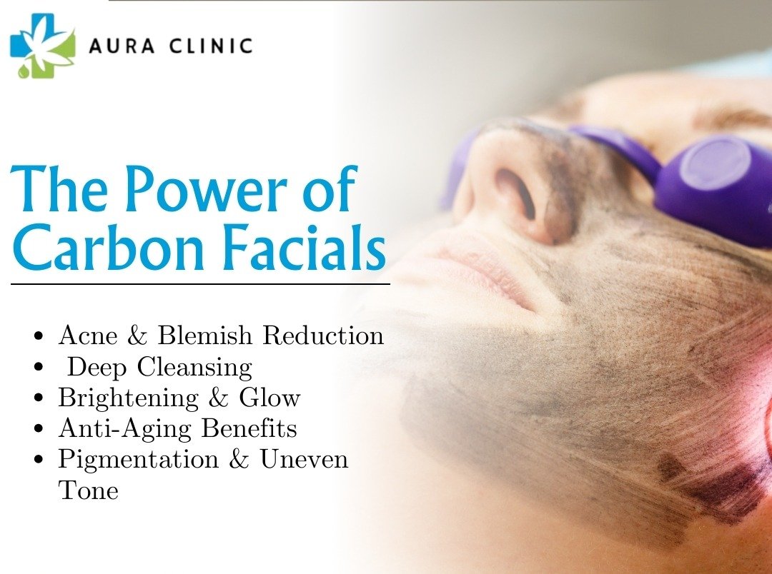 CARBON FACIAL