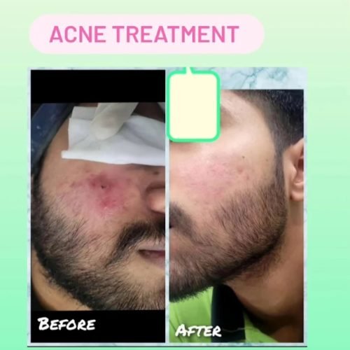 Screenshot_20260205_205137_Google