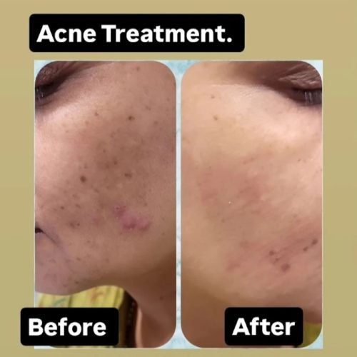 Screenshot_20260205_205202_Google